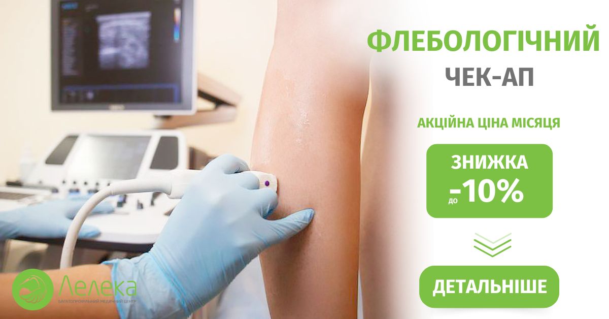Знижка до -10% на операції для лікування варикозу