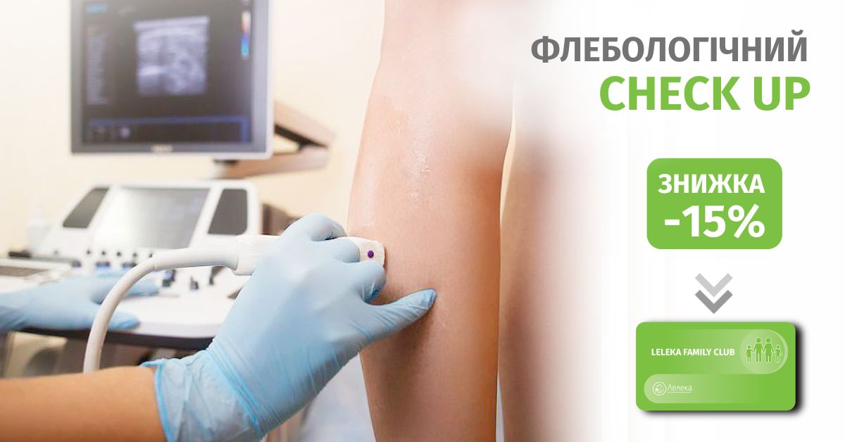 Знижка до -10% на операції для лікування варикозу